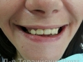20130514_100337