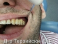 20140612_184327