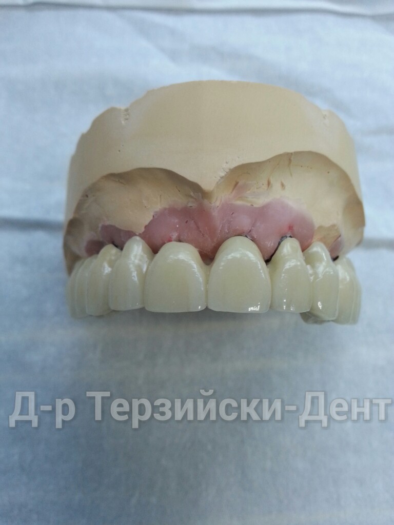 20140731_151534
