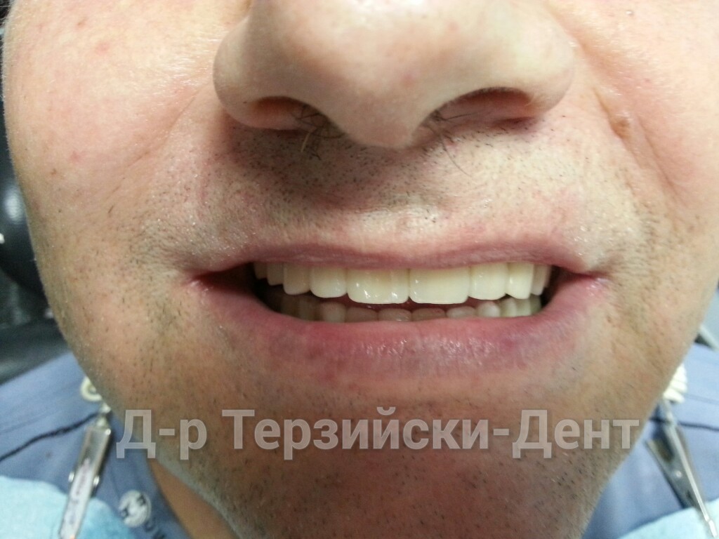 20140731_164158