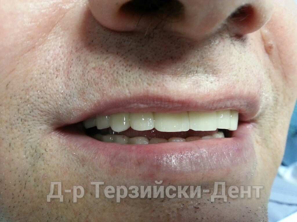 20140731_164202