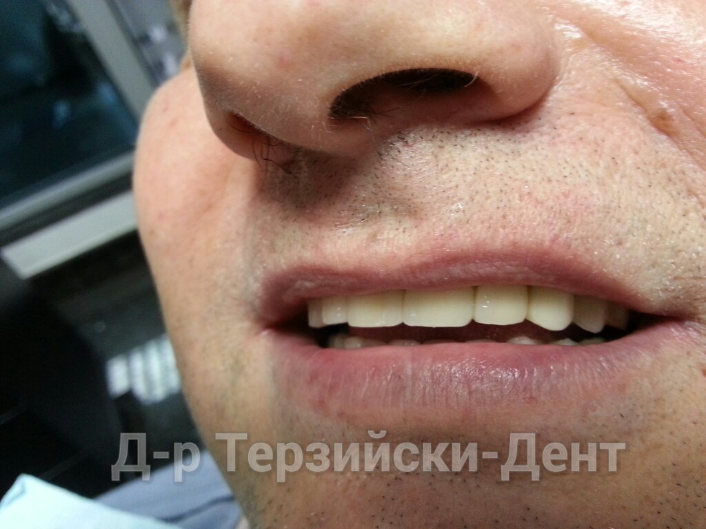 20140731_164205