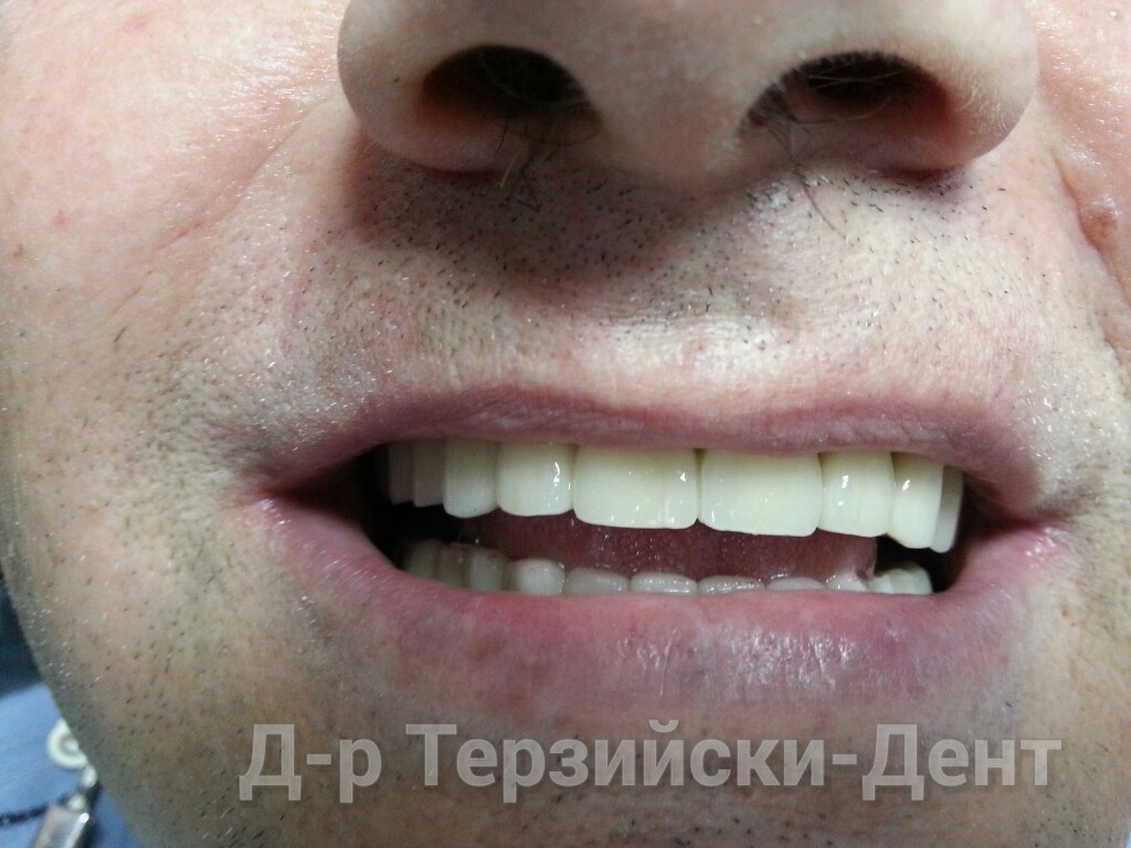 20140731_164215