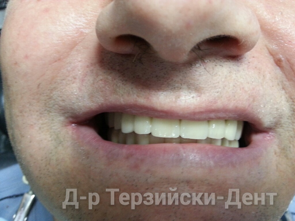 20140731_164220