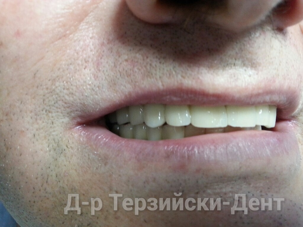 20140731_164223