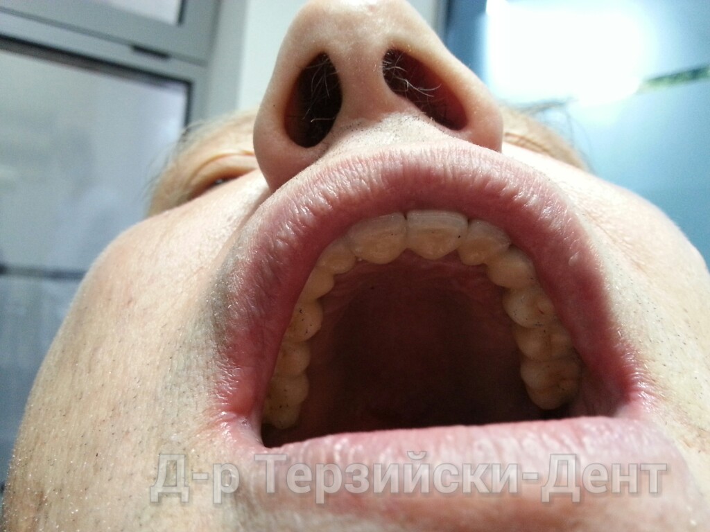 20140731_164237