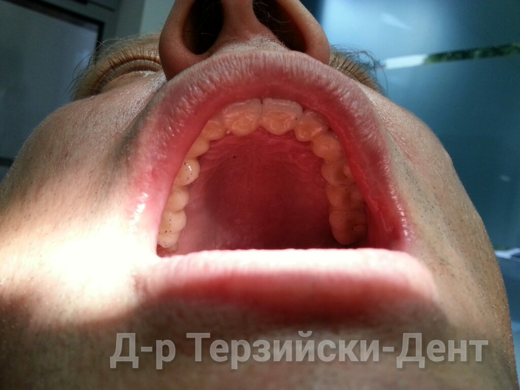 20140731_164246