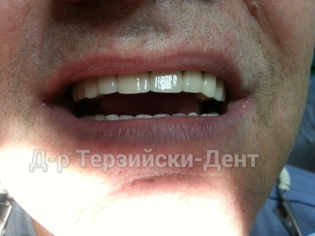 20140731_164255