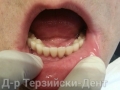 2014-04-25 09.39.30