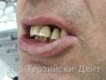 20130605_153826