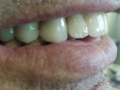 image-1ccde4069a09e03de35dff75d6ea6e04d3e8c228ebf7af710fe888d63b2645cf-V