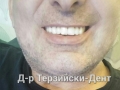 image-b7c50989102d78f929bd7cdfa0552f46b0cb362135337c4d589a114f5eef72fd-V-1