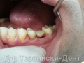 20140225_101951
