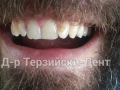20140705_161135