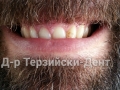 20140705_161153