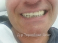 20140716_142135
