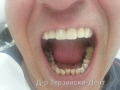 20140716_142145
