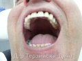 20140716_142206