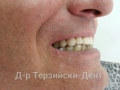 20140716_142217