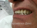 20140716_142227