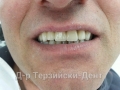 20140716_142246