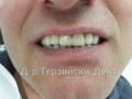 20140716_142247