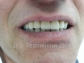20140716_142250