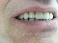 20140716_142253