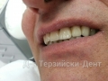 20140716_142255