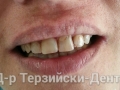 20140705_190903-1-1
