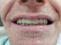 20150106_130815