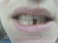 20140927_154619