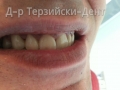 20150205_114251