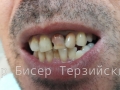 20151021_180436