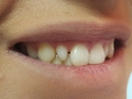 20151117_095655-1
