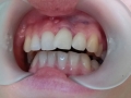 20170714_100442